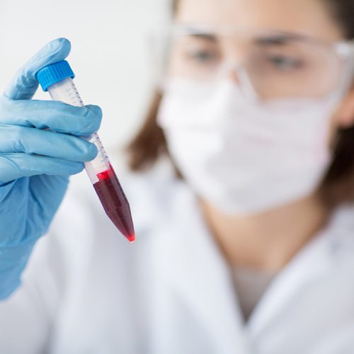 Lab Tech Holding Vial Web