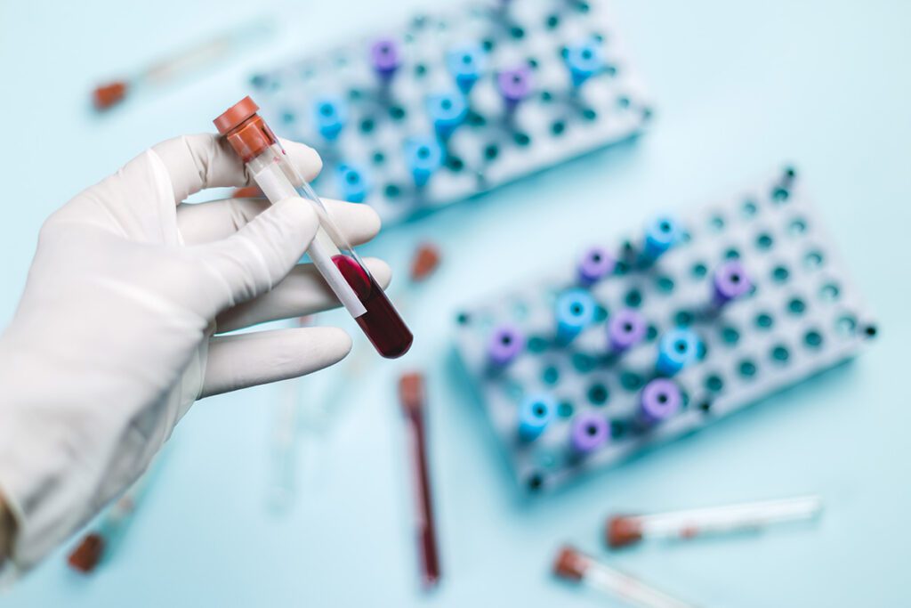 cord blood stem cell banking laboratory samples 1