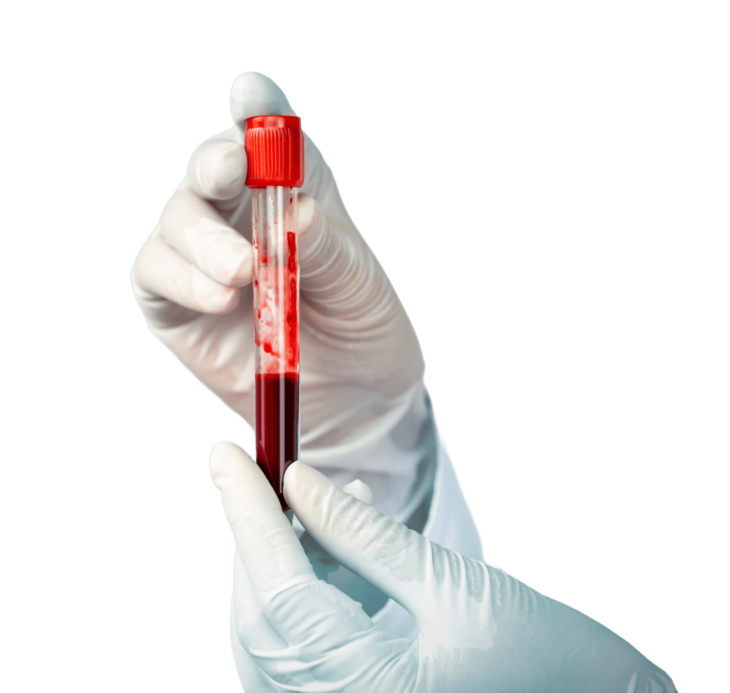 cord blood stem cell sample vial laboratory