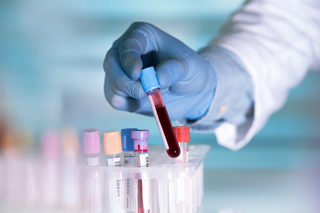 Cord Blood Sample Being Processed at an AABB Accredited Cord Blood Bank Laboratory