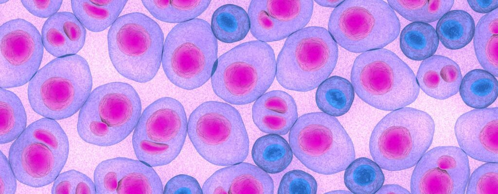 can cord blood stem cells cure leukemia