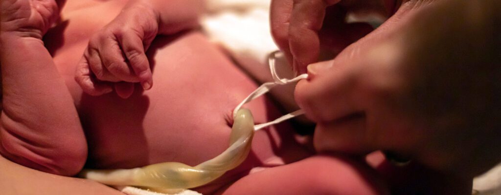 can you delay cord clamping with c section