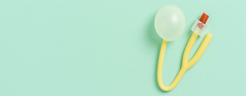 foley balloon induction benefits risks and how long it takes