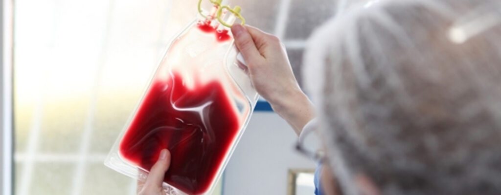 how is cord blood collected